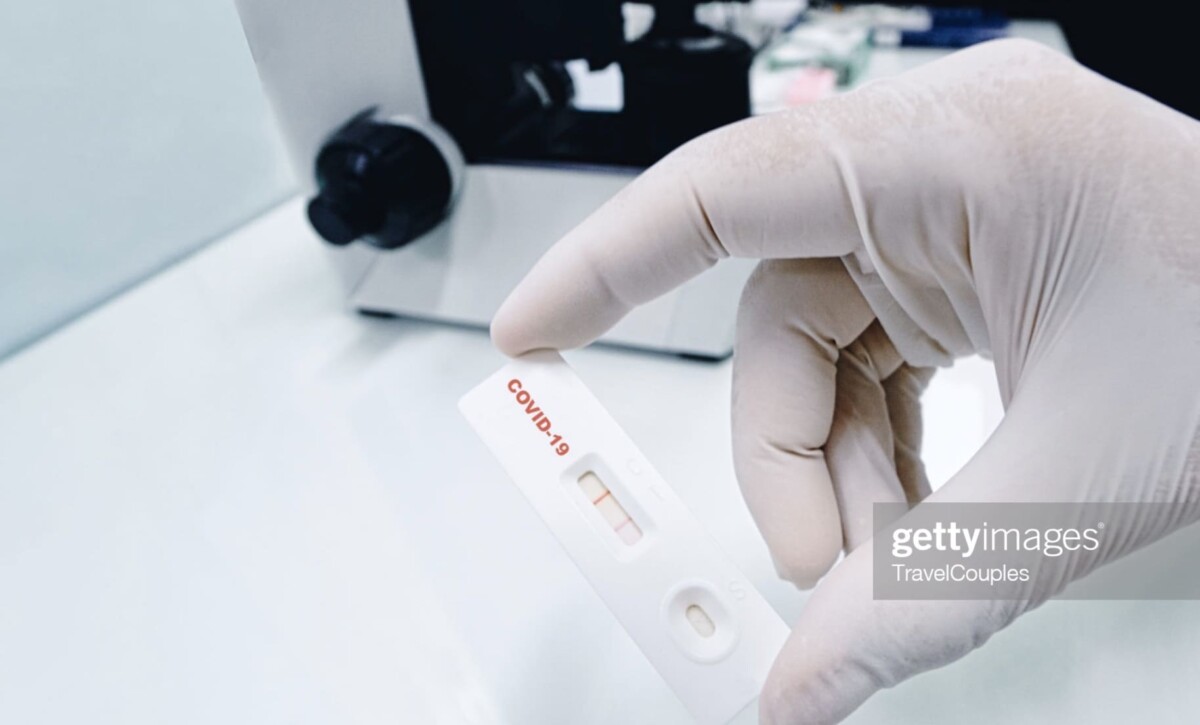 Test antigenos anticuerpos coronavirus covid 19 Centro Medico Neroma Sant Feliu de Llobregat Renovacion carnet de conducir y certificado medico oficial.